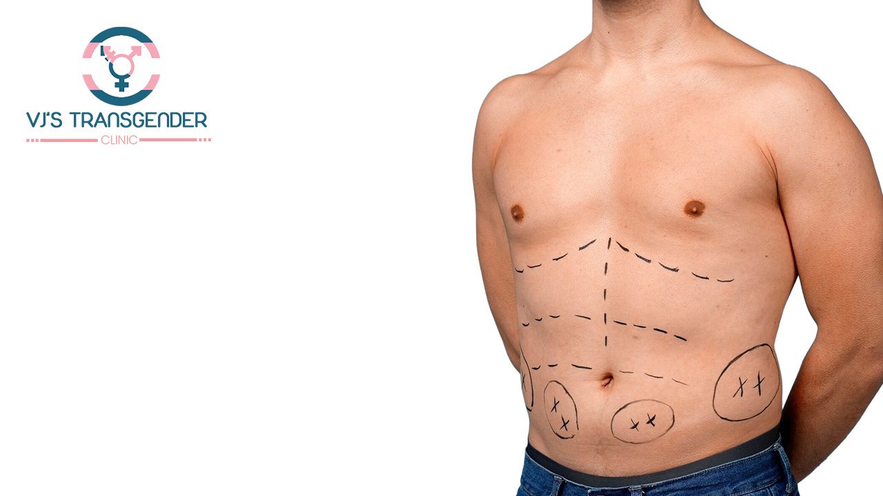 Post-Surgery Recovery: Healing Process & Care Tips