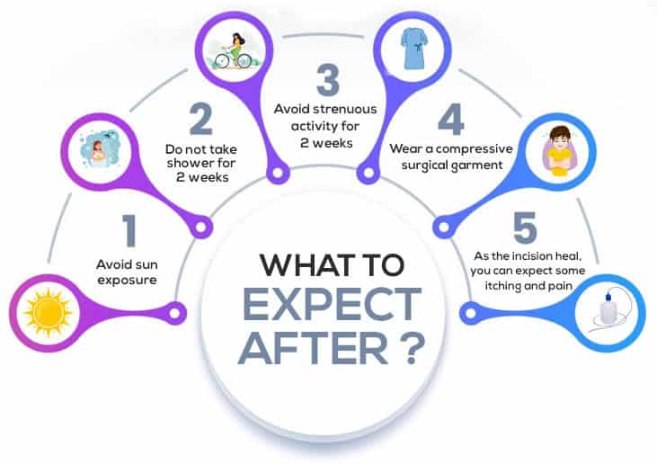 Sun exposure advice after transgender surgery, trans health recovery tips.