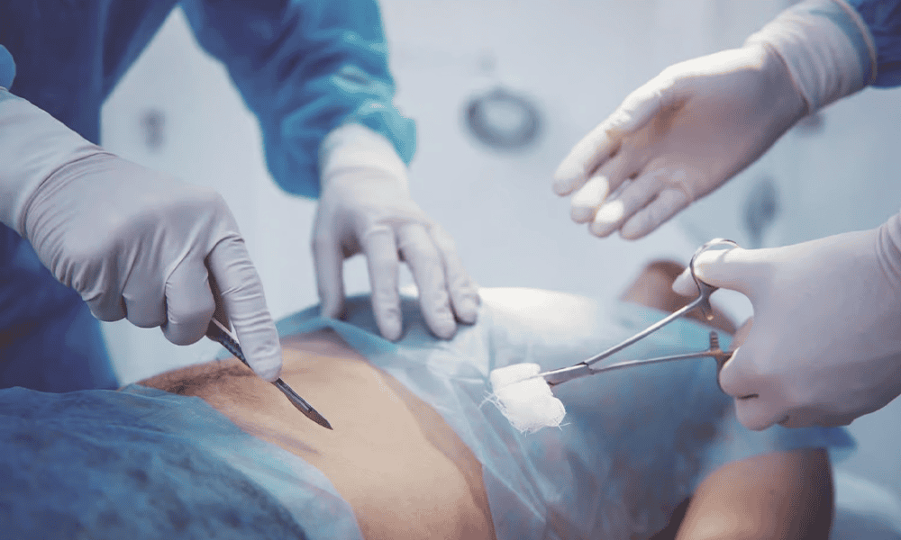 Minimally invasive gender affirmation surgery procedure at VJ Transgender Clinics.