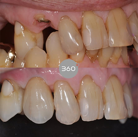 Before and after close-up: 