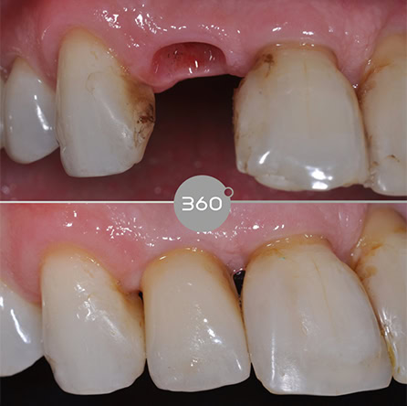 Before and after close-up: 