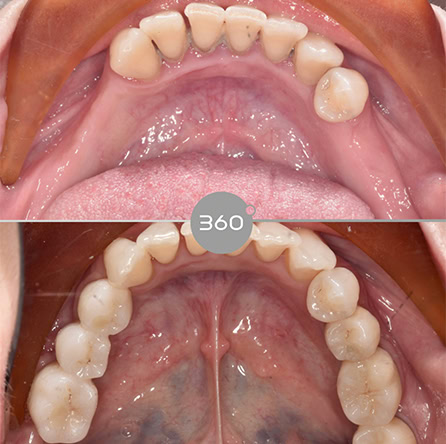 Before and after close-up: 