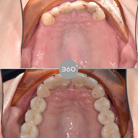 Before and after close-up: 