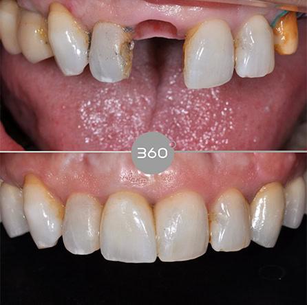 Before and after close-up: 