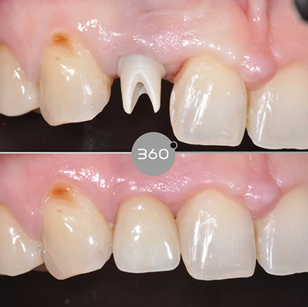 Before and after close-up: 