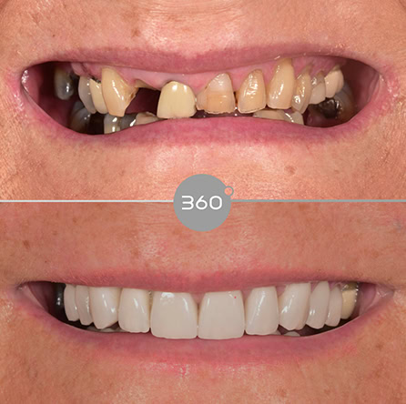 Before and after close-up: 