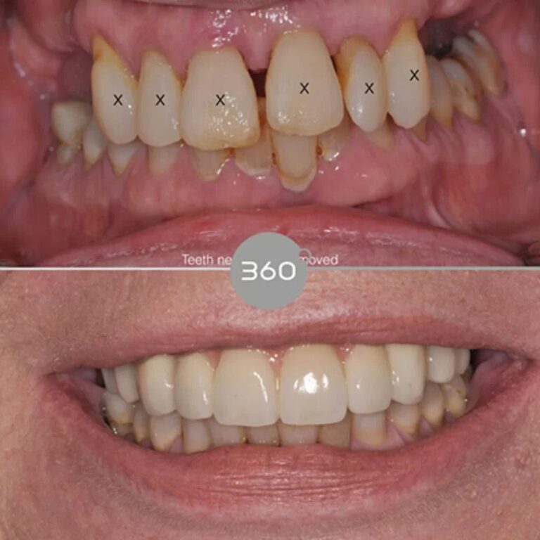 Before and after close-up: 