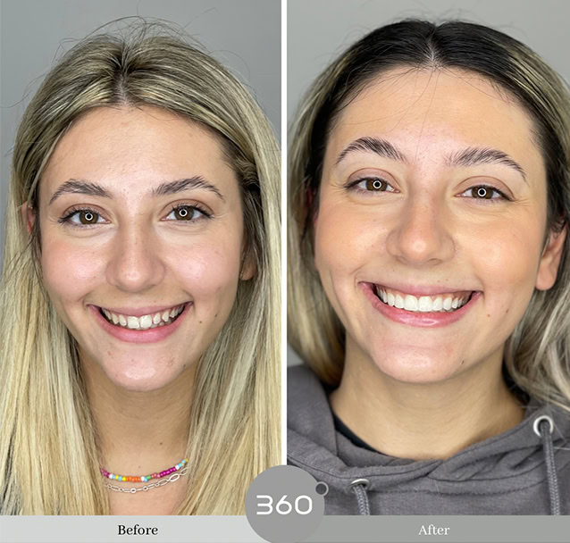 Before and after : 