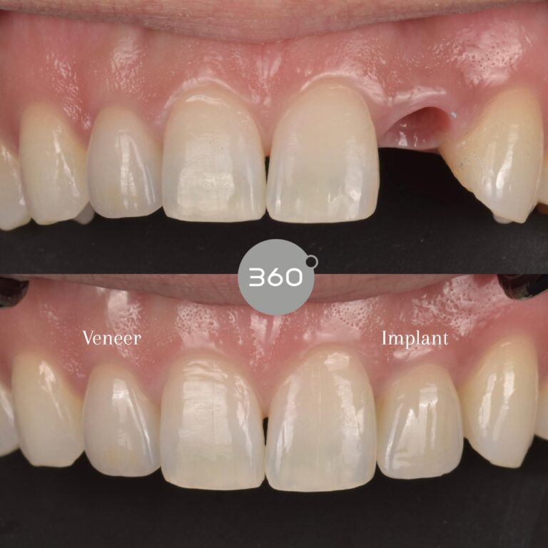 Before and after close-up: 
