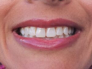 Example close-up smile photo