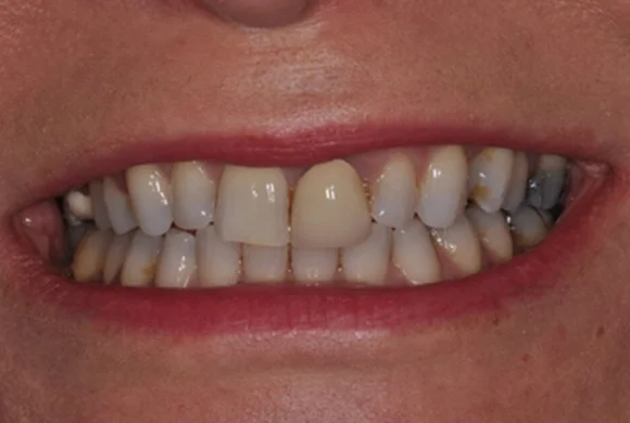 Before close-up: 