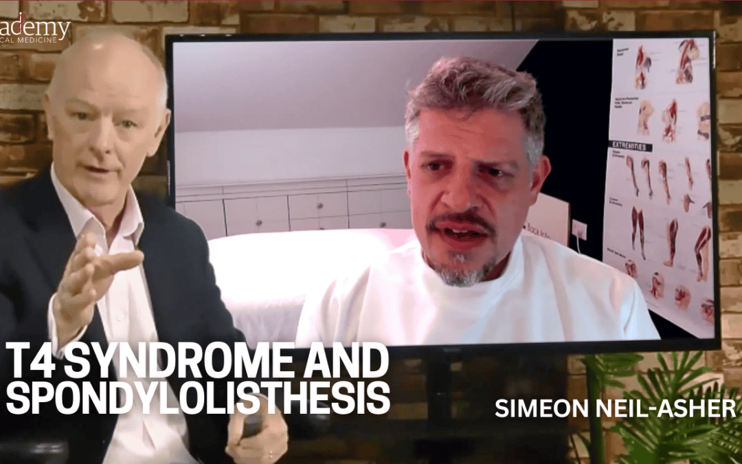 T4 Syndrome and Spondylolisthesis