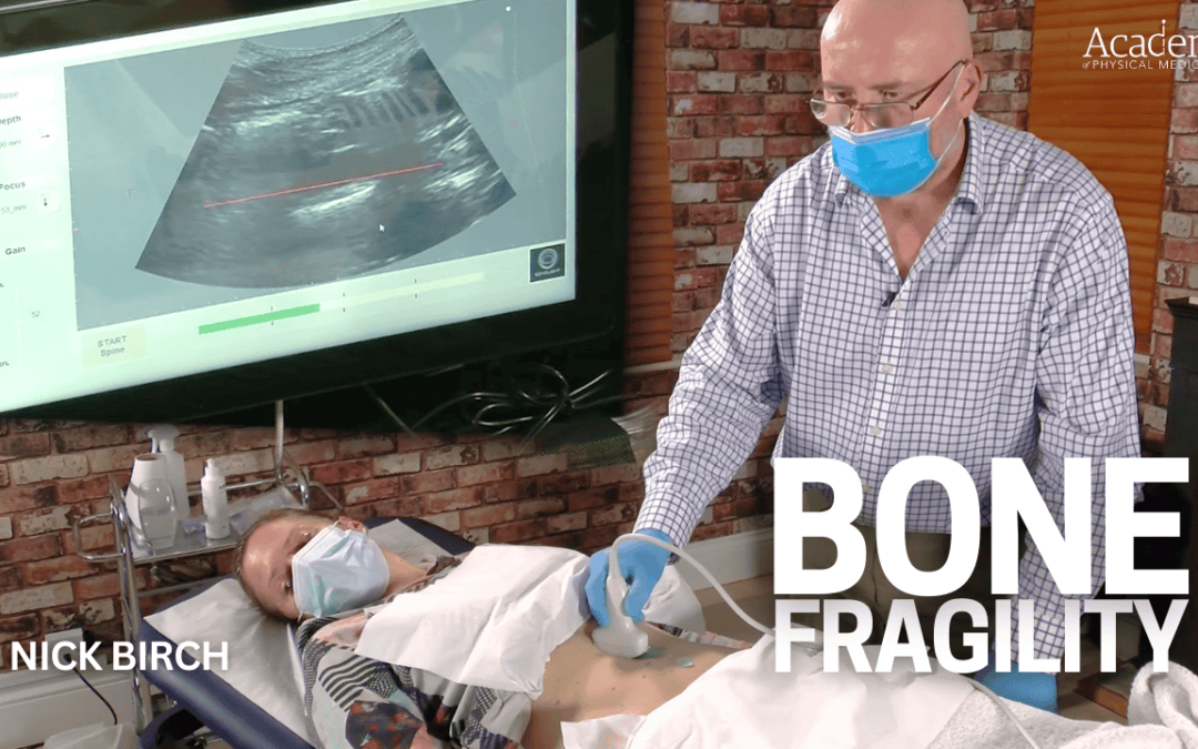 Bone Fragility