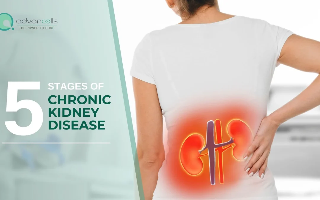 Stages of chronic Kidney disorder | Advancells