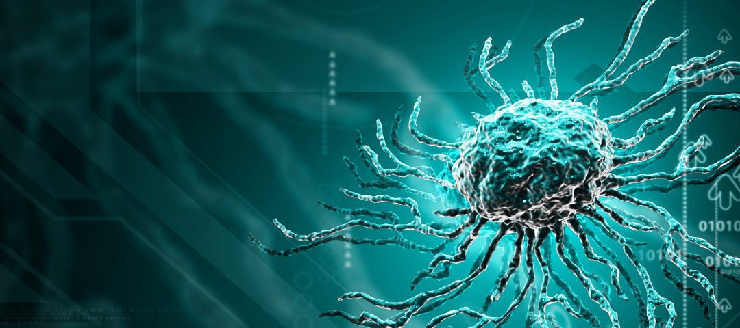 Chronic Critical Limb Ischemia: Diagnosis And Treatment