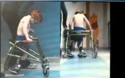 Cerebral Palsy Patient Treatment Testimonial Video