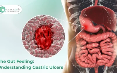 The Gut Feeling: Understanding Gastric Ulcers