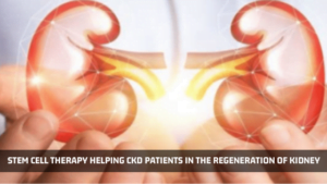 Stem Cell Therapy for Chronic Kidney Disease