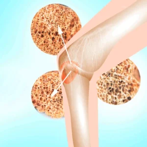 Never pursue such a delicate treatment procedure without consulting a doctor, oncologist, or hematologist.