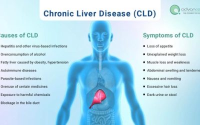 Chronic Liver Disease (CLD) – Causes, Symptoms, Available Treatments