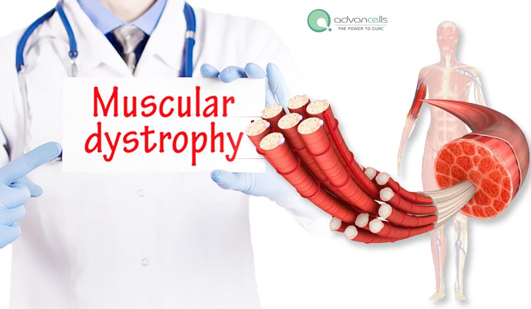 Symptoms and Types of Muscular Dystrophy