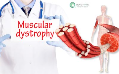 Muscular Dystrophy Types, Symptoms, Diagnosis And Treatment