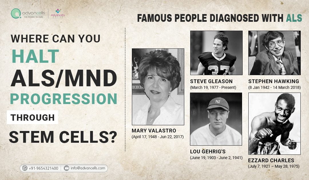 Stem Cell Treatment for ALS & MND