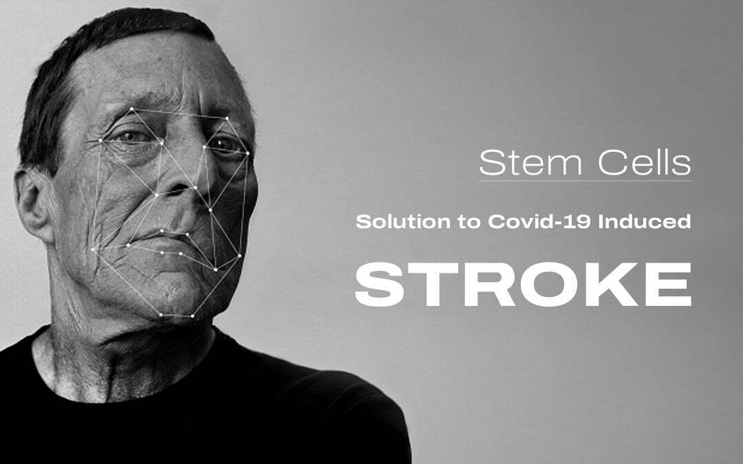 How Long is Stroke Recovery with Minimum Cost?