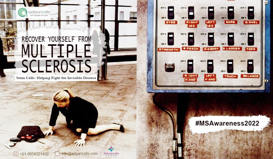 Why is Multiple Sclerosis more Common in Females