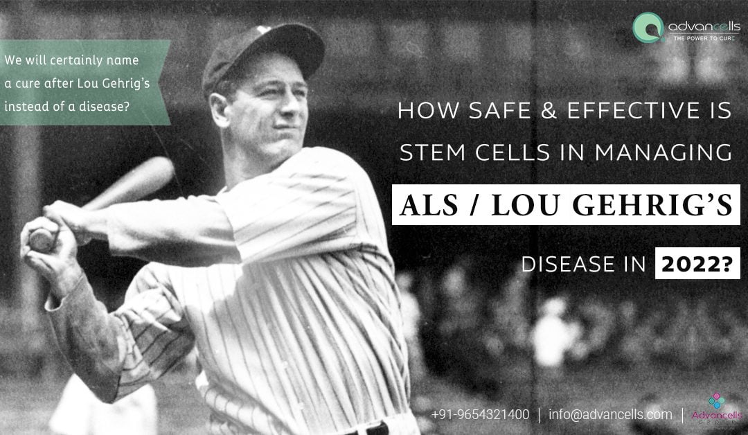 Efficacy of Stem Cell Therapy for ALS