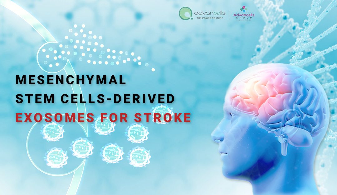 Does Exosome Therapy Work for Stroke?