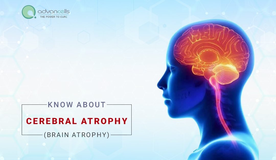 Brain Cerebral Atrophy