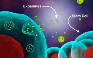 Stem-Cells-Versus-Exosomes