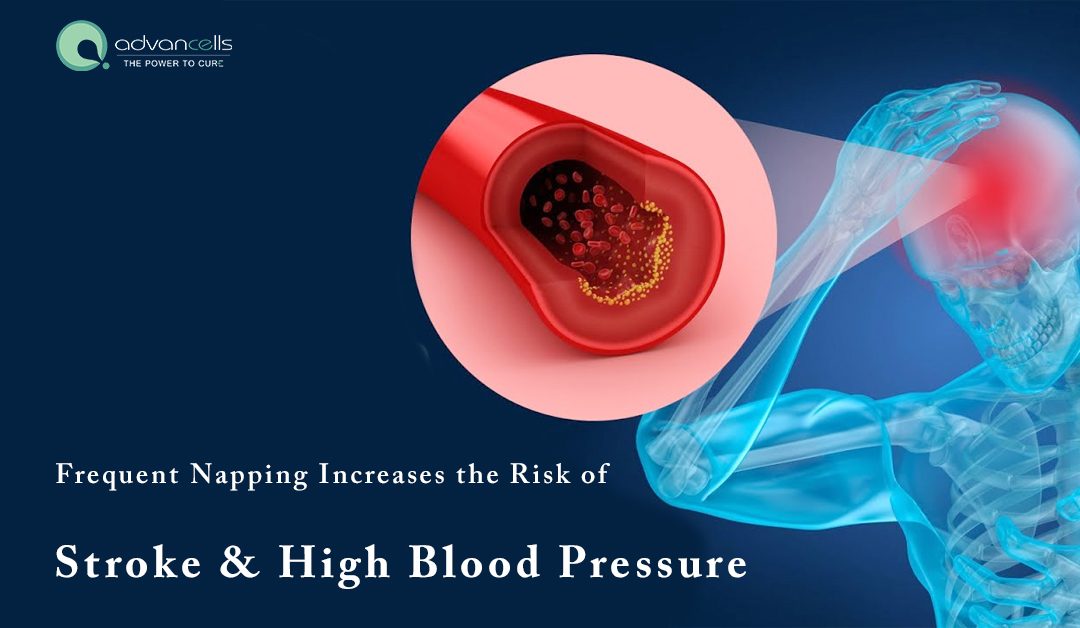 How Frequent Napping Linked to High Blood Pressure and Stroke?