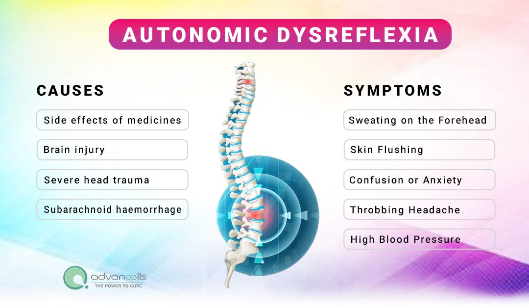 Spinal Cord Injury Autonomic Dysreflexia: Symptoms, Causes, and Treatment