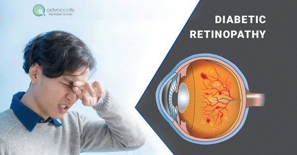 Diabetic Retinopathy – Symptoms, Causes, Stages and Treatment