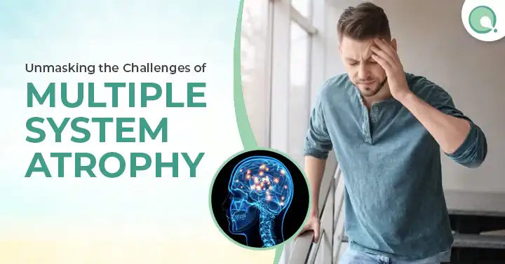 Multiple System Atrophy Unraveling the Challenges of a Rare Neurological Disorder