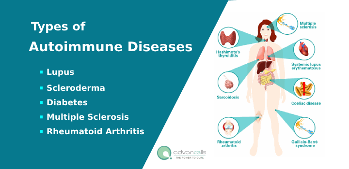 Common Autoimmune Diseases List and Symptoms