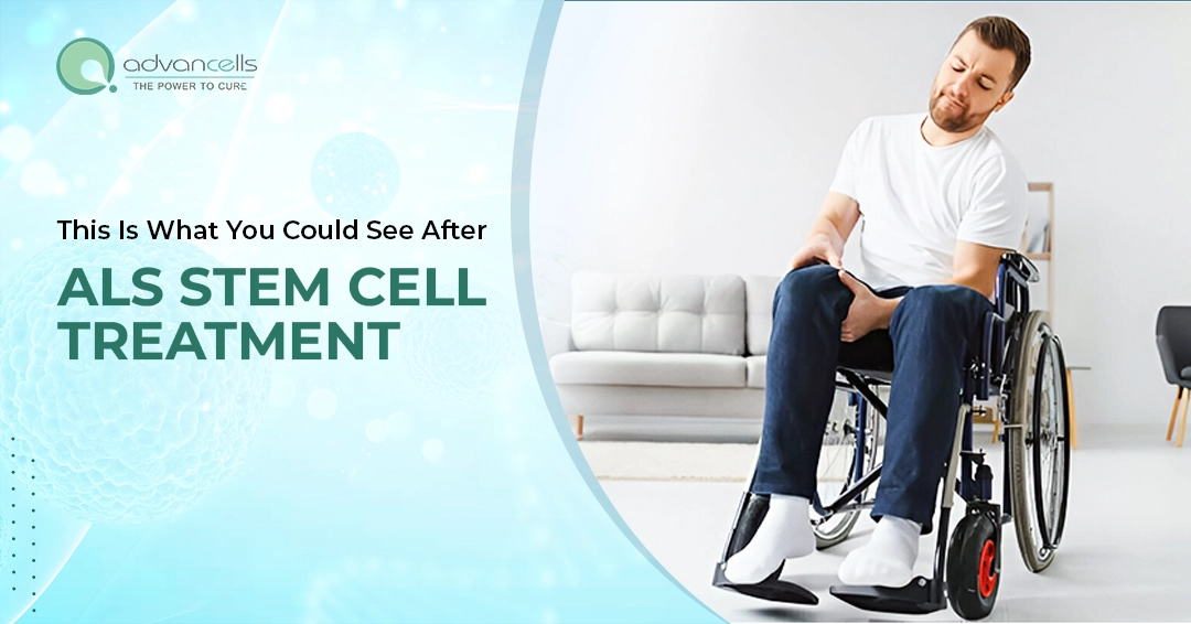 This Is What You Could See After ALS Stem Cell Treatment