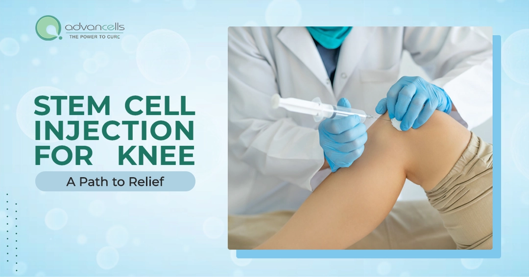 Stem cell treatment for knee pain | Advancells