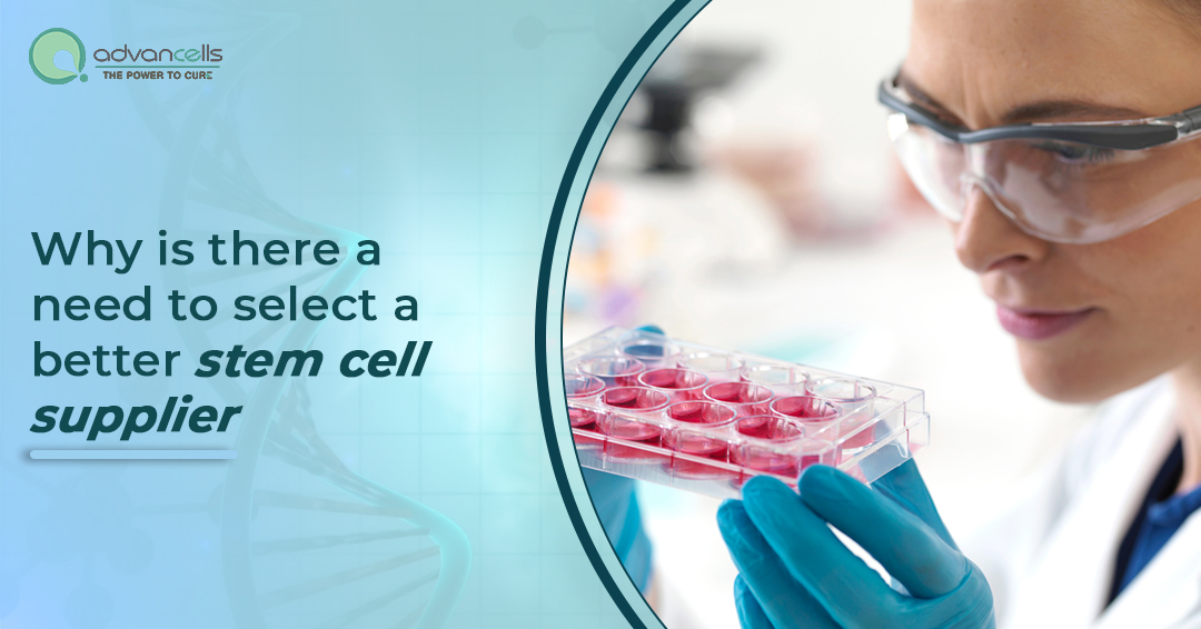 Why is there a need to select a better stem cell supplier