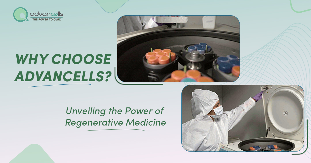 Why Choose Advancells? Unveiling the Power of Regenerative Medicine