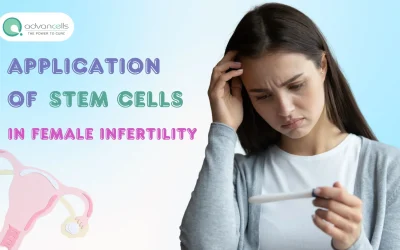 Female Infertility: Application & Benefits of Stem Cells