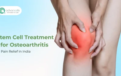 Stem Cell Treatment for Osteoarthritis Pain Relief in India