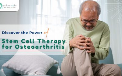 Discover the Power of Stem Cell Therapy for Osteoarthritis