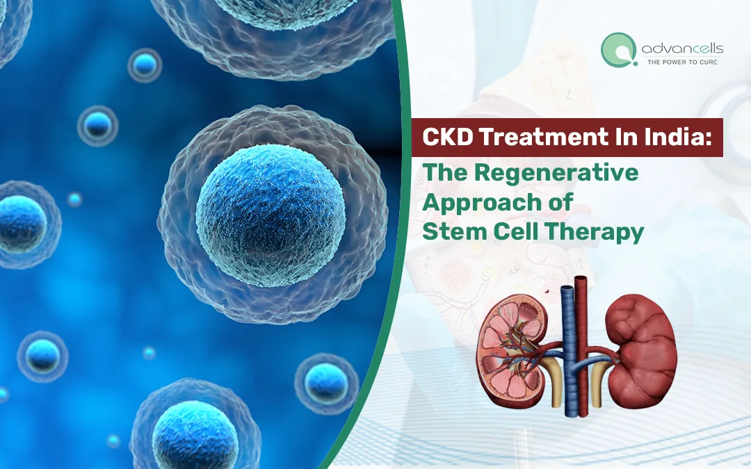 CKD Treatment In India: The Regenerative Approach of Stem Cell Therapy