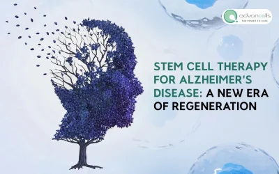 Stem Cell Therapy for Alzheimer’s Disease: A New Era of Regeneration