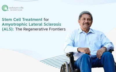 Stem Cell Treatment for Amyotrophic Lateral Sclerosis (ALS): The Regenerative Frontiers