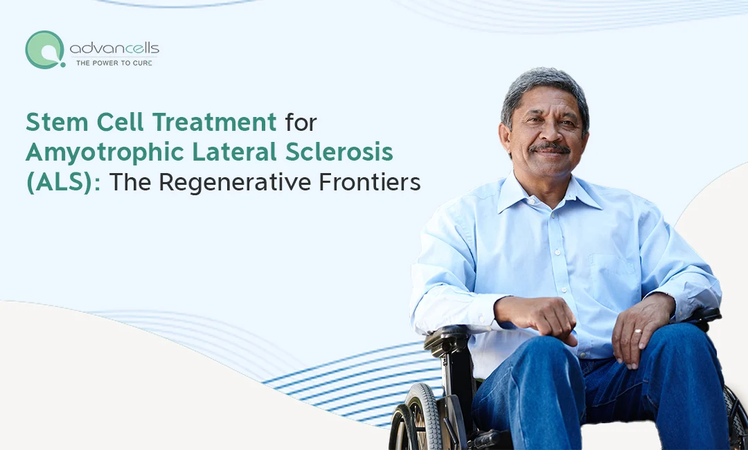 Stem Cell Treatment for Amyotrophic Lateral Sclerosis (ALS): The Regenerative Frontiers