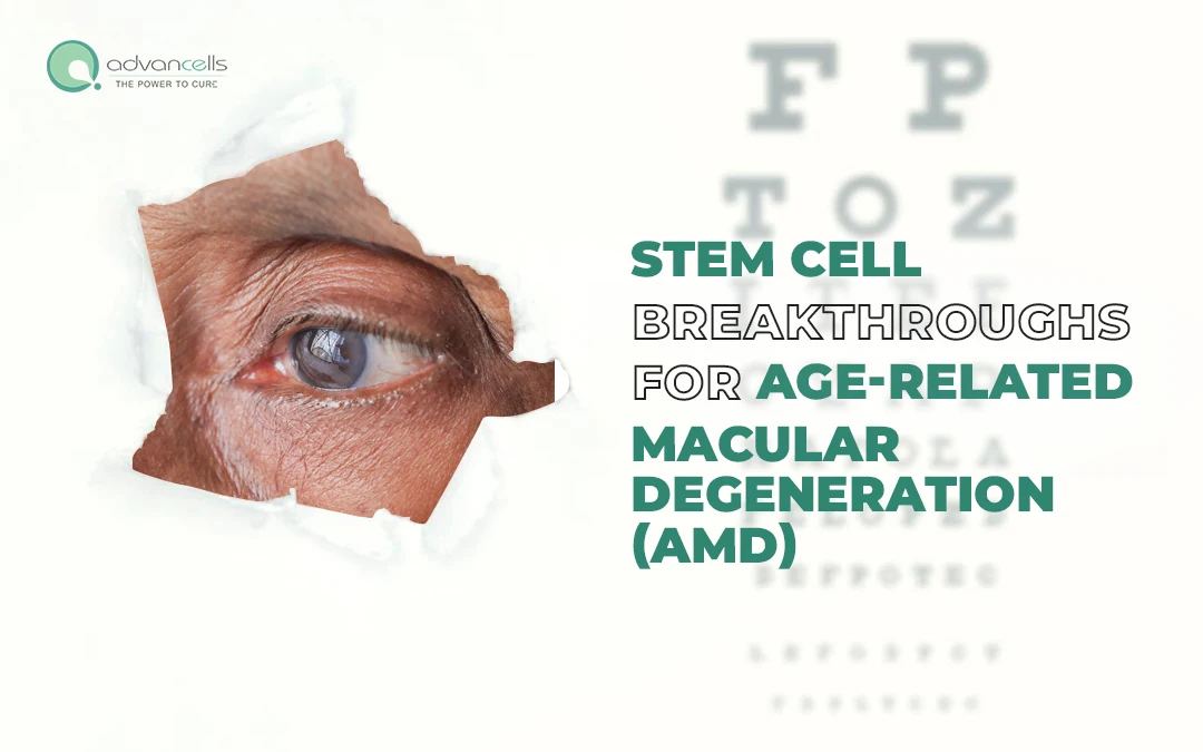 Stem Cell Breakthroughs for Age-Related Macular Degeneration (AMD)
